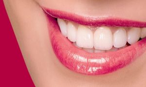 Bọc răng sứ có cần phải lấy tủy không?