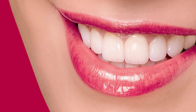 Bọc răng sứ có cần phải lấy tủy không?