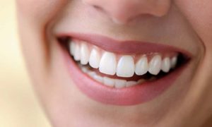 Bọc răng sứ ở tại Biên Hòa - Đồng Nai có đau không?