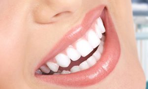 Bọc răng sứ cho răng sâu nên chọn răng nào?