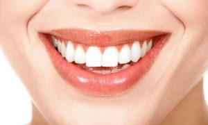 Hư tủy do sâu răng có nên bọc răng sứ?